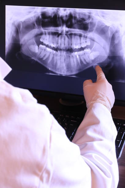 Best Emergency Treatment for Toothache in Davie, FL